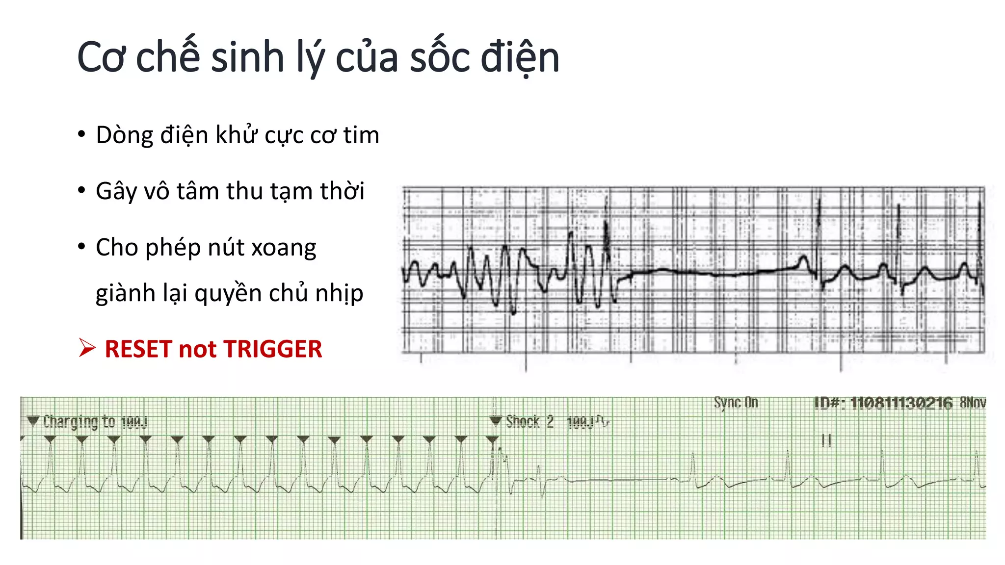 Sốc điện | PPTX