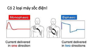 Có 2 loại máy sốc điện!
 