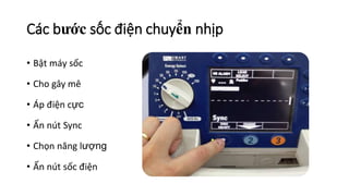Các bước sốc điện chuyển nhịp
• Bật máy sốc
• Cho gây mê
• Áp điện cực
• Ấn nút Sync
• Chọn năng lượng
• Ấn nút sốc điện
 