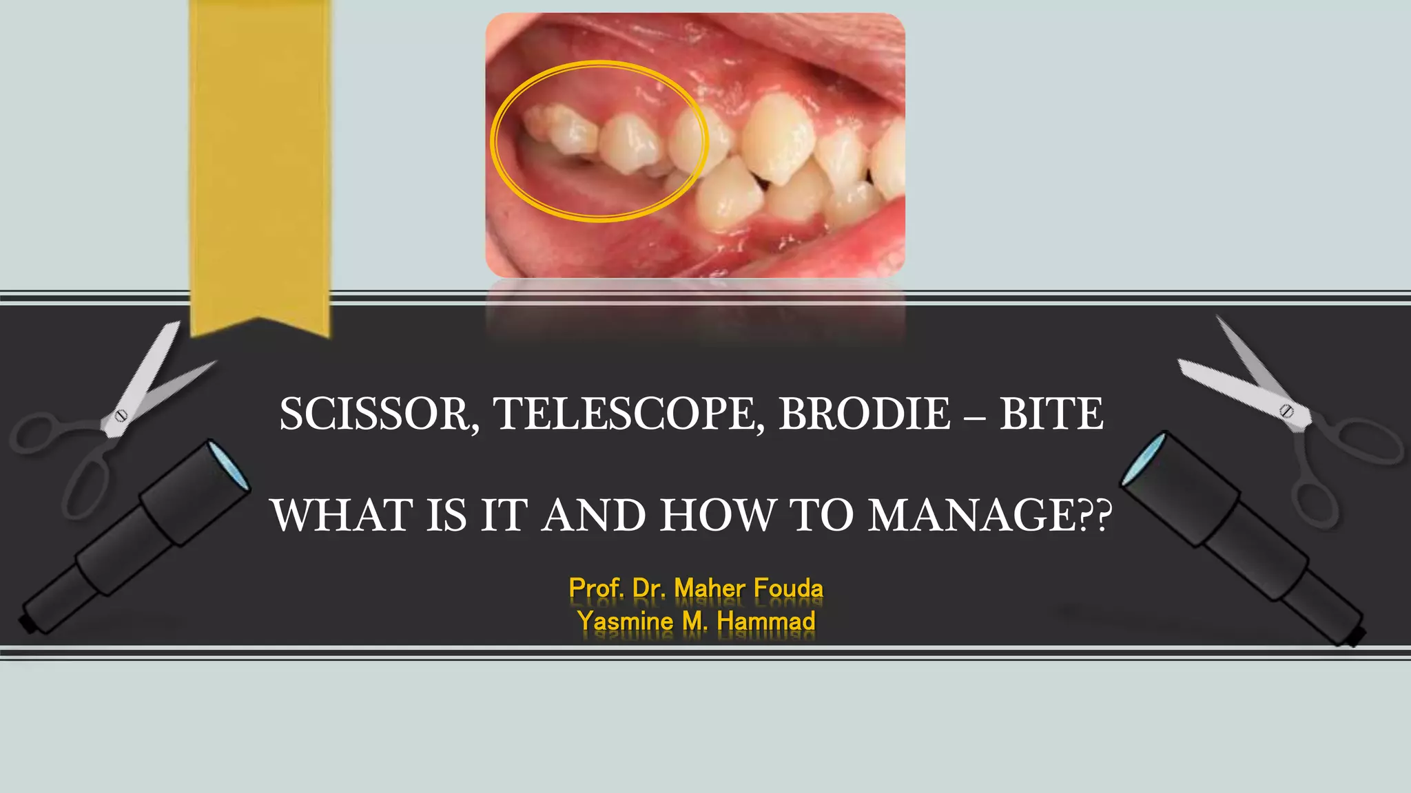 Scissor. telescope. brodie. bite PPT