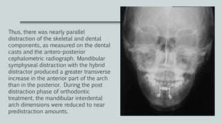 Thus, there was nearly parallel
distraction of the skeletal and dental
components, as measured on the dental
casts and the antero-posterior
cephalometric radiograph. Mandibular
symphyseal distraction with the hybrid
distractor produced a greater transverse
increase in the anterior part of the arch
than in the posterior. During the post
distraction phase of orthodontic
treatment, the mandibular interdental
arch dimensions were reduced to near
predistraction amounts.
 
