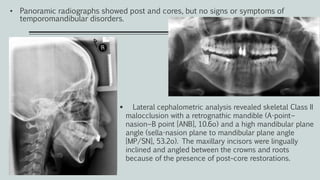 • Panoramic radiographs showed post and cores, but no signs or symptoms of
temporomandibular disorders.
 Lateral cephalometric analysis revealed skeletal Class II
malocclusion with a retrognathic mandible (A-point−
nasion−B point [ANB], 10.6o) and a high mandibular plane
angle (sella-nasion plane to mandibular plane angle
[MP/SN], 53.2o). The maxillary incisors were lingually
inclined and angled between the crowns and roots
because of the presence of post–core restorations.
 