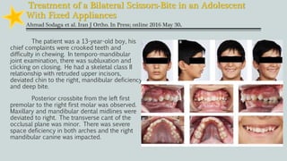Treatment of a Bilateral Scissors-Bite in an Adolescent
With Fixed Appliances
Ahmad Sodaga et al. Iran J Ortho. In Press; online 2016 May 30.
The patient was a 13-year-old boy, his
chief complaints were crooked teeth and
difficulty in chewing. In temporo-mandibular
joint examination, there was subluxation and
clicking on closing. He had a skeletal class II
relationship with retruded upper incisors,
deviated chin to the right, mandibular deficiency
and deep bite.
Posterior crossbite from the left first
premolar to the right first molar was observed.
Maxillary and mandibular dental midlines were
deviated to right. The transverse cant of the
occlusal plane was minor. There was severe
space deficiency in both arches and the right
mandibular canine was impacted.
 