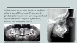  As like the other non-extraction therapies in mandibular
deficiency cases, IMPA increased. We suggested the
parents to perform advancement genioplasty procedure at
18-year-old to enhance his profile. By this means,
Holdaway ratio would greatly improve.
 