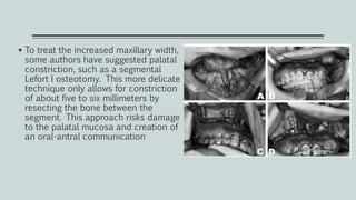  To treat the increased maxillary width,
some authors have suggested palatal
constriction, such as a segmental
Lefort I osteotomy. This more delicate
technique only allows for constriction
of about five to six millimeters by
resecting the bone between the
segment. This approach risks damage
to the palatal mucosa and creation of
an oral-antral communication
 