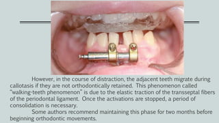 However, in the course of distraction, the adjacent teeth migrate during
callotasis if they are not orthodontically retained. This phenomenon called
‘‘walking-teeth phenomenon’’ is due to the elastic traction of the transseptal fibers
of the periodontal ligament. Once the activations are stopped, a period of
consolidation is necessary.
Some authors recommend maintaining this phase for two months before
beginning orthodontic movements.
 