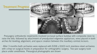 Presurgery orthodontic treatments involved occlusal surface buildup with composite resin to
raise the bite, followed by attachment of preadjusted edgewise appliances, wires placed in both
arches for leveling, alignment, and space creation between the maxillary central incisors.
After 3 months both archwires were replaced with 0.016 x 0.022–inch stainless-steel archwires
with crimp-on surgical hooks in preparation for orthognathic surgery. Two-jaw surgery took
place under anesthesia. Presurgical photographs are shown
Treatment Progress
 