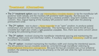 Treatment Alternatives
 The 1st treatment option: was to use intermaxillary crossbite elastics to tip the mandibular left
posterior teeth labially and the maxillary left posterior teeth lingually. But because the
diagnosis indicated the crossbite was primarily a skeletal problem, long-term stability was a
concern. Also, lingual tipping of the maxillary left posterior teeth might alter the pleasing
pretreatment smile.
 The 2nd option: was to place a Hyrax expander in an “open” position, to produce palatal
constriction and narrow the maxilla bilaterally. This technique would correct the left buccal
crossbite but might also create a right posterior crossbite. Also, there was some concern about
changing the preexisting broad smile.
 The 3rd option: involved closing the mandibular interdental spacing and maintaining the
mandibular intercanine and intermolar widths. A maxillary segmental osteotomy could be used
to correct the crossbite.
 The 4th option : involved maintaining the maxillary width and closing the interdental spaces.
The left posterior buccal crossbite would be corrected through mandibular widening by
midsymphyseal distraction osteogenesis. Because the buccal crossbite was a true unilateral
problem, the widening would have to be primarily on the left side while the right occlusion was
maintained.
 