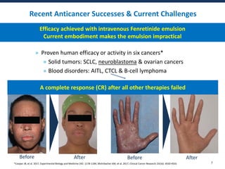 Recent Anticancer Successes & Current Challenges
» Proven human efficacy or activity in six cancers*
» Solid tumors: SCLC,...