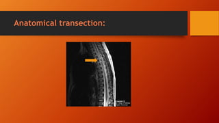 Anatomical transection:
 