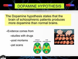 DOPAMINE HYPOTHESIS
The Dopamine hypothesis states that the
brain of schizophrenic patients produces
more dopamine than normal brains.
–Evidence comes from
–studies with drugs
–post mortems
–pet scans
 