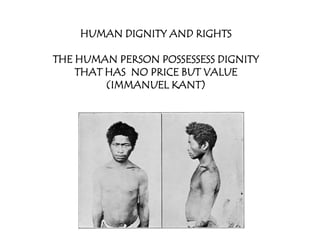 HUMAN DIGNITY AND RIGHTS

THE HUMAN PERSON POSSESSESS DIGNITY
    THAT HAS NO PRICE BUT VALUE
         (IMMANUEL KANT)
 