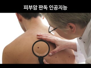 피부암 판독 인공지능
 