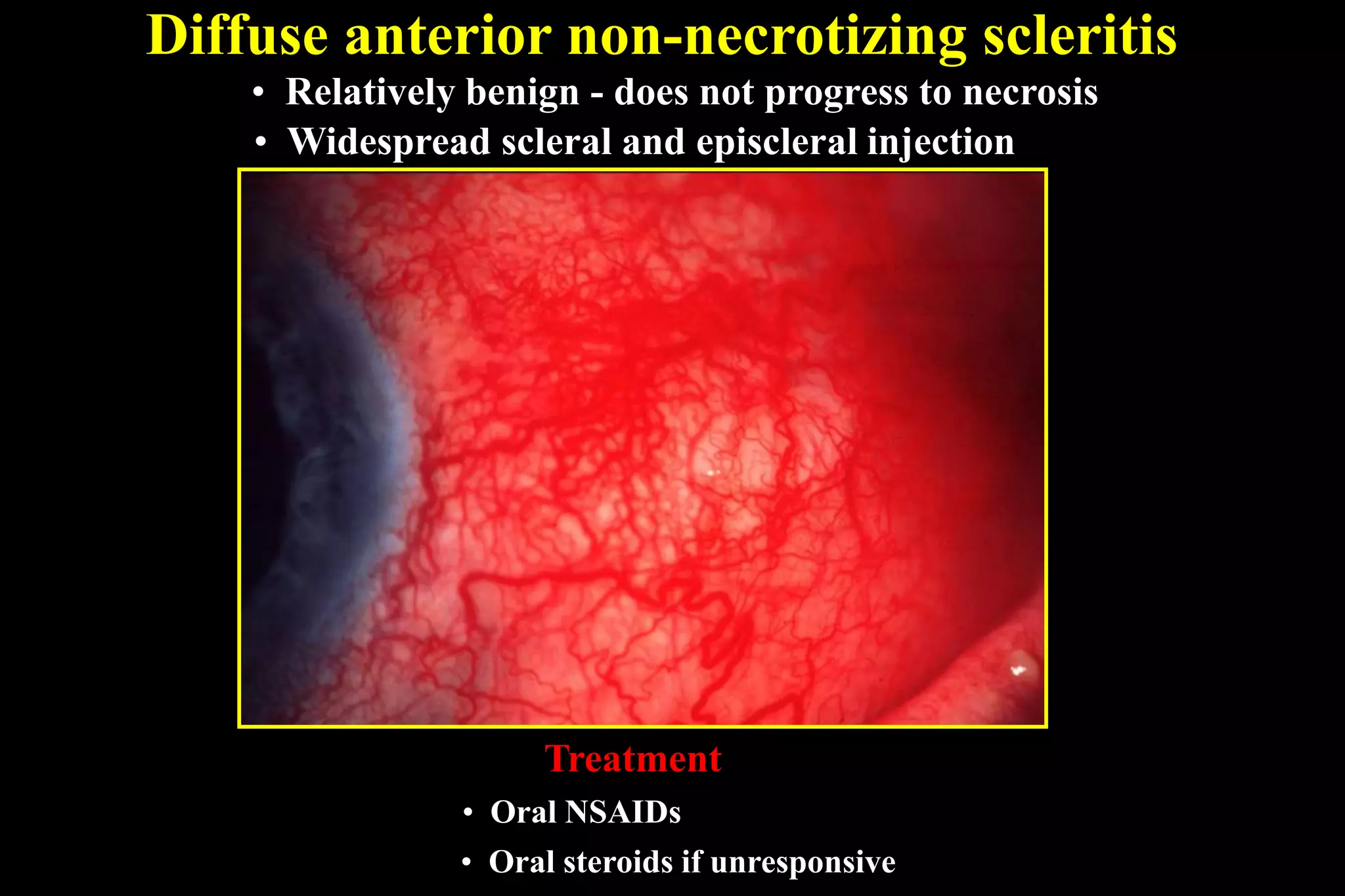 Sclera | PPT