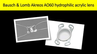Bausch & Lomb Akreos AO60 hydrophilic acrylic lens
 