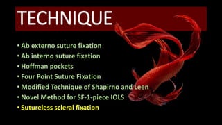 TECHNIQUE
• Ab externo suture fixation
• Ab interno suture fixation
• Hoffman pockets
• Four Point Suture Fixation
• Modified Technique of Shapirno and Leen
• Novel Method for SF-1-piece IOLS
• Sutureless scleral fixation
 