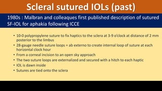 • 10-0 polypropylene suture to fix haptics to the sclera at 3-9 o’clock at distance of 2 mm
posterior to the limbus
• 28-gauge needle suture loops = ab externo to create internal loop of suture at each
horizontal clock hour
• From a corneal incision to an open sky approach
• The two suture loops are externalized and secured with a hitch to each haptic
• IOL is dawn inside
• Sutures are tied onto the sclera
Scleral sutured IOLs (past)
1980s : Malbran and colleaques first published description of sutured
SF-IOL for aphakia following ICCE
 