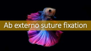 Ab externo suture fixation
 