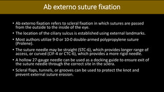 Ab externo suture fixation
• Ab externo fixation refers to scleral fixation in which sutures are passed
from the outside to the inside of the eye.
• The location of the ciliary sulcus is established using external landmarks.
• Most authors utilize 9-0 or 10-0 double-armed polypropylene suture
(Prolene).
• The suture needle may be straight (STC-6), which provides longer range of
access, or curved (CIF-4 or CTC-6), which provides a more rigid needle.
• A hollow 27-gauge needle can be used as a docking guide to ensure exit of
the suture needle through the correct site in the sclera.
• Scleral flaps, tunnels, or grooves can be used to protect the knot and
prevent external suture erosion.
 
