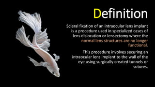 Definition
Scleral fixation of an intraocular lens implant
is a procedure used in specialized cases of
lens dislocation or lensectomy where the
normal lens structures are no longer
functional.
This procedure involves securing an
intraocular lens implant to the wall of the
eye using surgically created tunnels or
sutures.
 