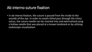 Ab interno suture fixation
• In ab interno fixation, the suture is passed from the inside to the
outside of the eye. In order to avoid a blind pass through the ciliary
sulcus, the suture needle can be inserted into and externalized using
a hollow needle that was placed at a known landmark or by utilizing
endoscopic visualization.
 