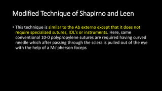 Modified Technique of Shapirno and Leen
• This technique is similar to the Ab externo except that it does not
require specialized sutures, IOL's or instruments. Here, same
conventional 10-0 polypropylene sutures are required having curved
needle which after passing through the sclera is pulled out of the eye
with the help of a Mc'pherson foceps
 