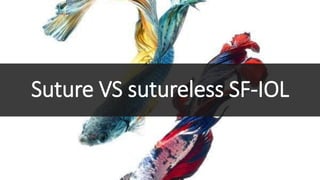 Suture VS sutureless SF-IOL
 