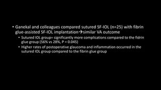 • Ganekal and colleagues compared sutured SF-IOL (n=25) with fibrin
glue-assisted SF-IOL implantationsimilar VA outcome
• Sutured IOL group= significantly more complications compared to the fidrin
glue group (56% vs 28%, P = 0.045)
• Higher rates of postoperative glaucoma and inflammation occurred in the
sutured IOL group compared to the fibrin glue group
 