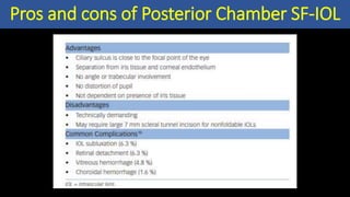 Pros and cons of Posterior Chamber SF-IOL
 