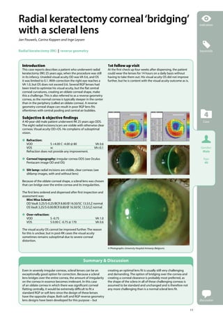 Scleral lens case report series beyond the corneal borders | PDF
