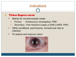 Indications
1. Vision Improvement
 Mainly for corneal ectasia cases
 Primary : Keratoconus, keratoglobus, PMD
 Secondary : Post refractive surgery (LASIK,LASEK, PRK)
 Other conditions: post trauma, corneal scar due to
infection
 To restore and improve vision
 