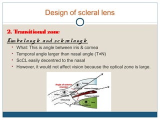 Design of scleral lens
2. Transitional zone
Lim balang le and scle ralang le
 What: This is angle between iris & cornea
 Temporal angle larger than nasal angle (T≠N)
 ScCL easily decentred to the nasal
 However, it would not affect vision because the optical zone is large.
 