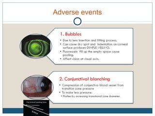 Adverse events
 