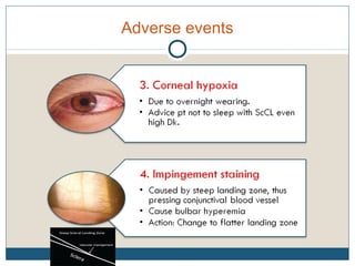 Adverse events
 