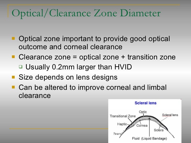 Scleral lenses presentation final (1)