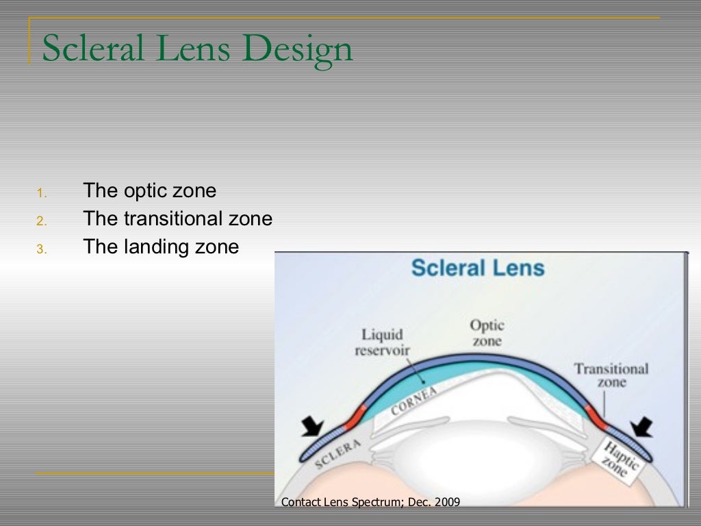 Scleral lenses presentation final (1)