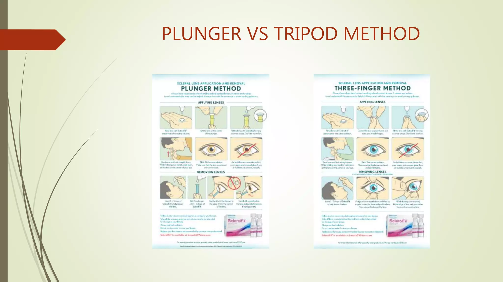 PLUNGER VS TRIPOD METHOD
 