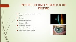 Scleral lens fitting | PPT