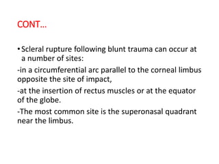 CONT…
•Scleral rupture following blunt trauma can occur at
a number of sites:
-in a circumferential arc parallel to the corneal limbus
opposite the site of impact,
-at the insertion of rectus muscles or at the equator
of the globe.
-The most common site is the superonasal quadrant
near the limbus.
 