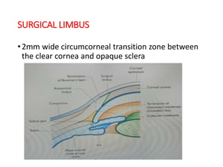 SURGICAL LIMBUS
•2mm wide circumcorneal transition zone between
the clear cornea and opaque sclera
 