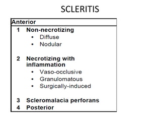 SCLERITIS
 