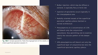 Systematic approach to a case of scleritis. | PPTX