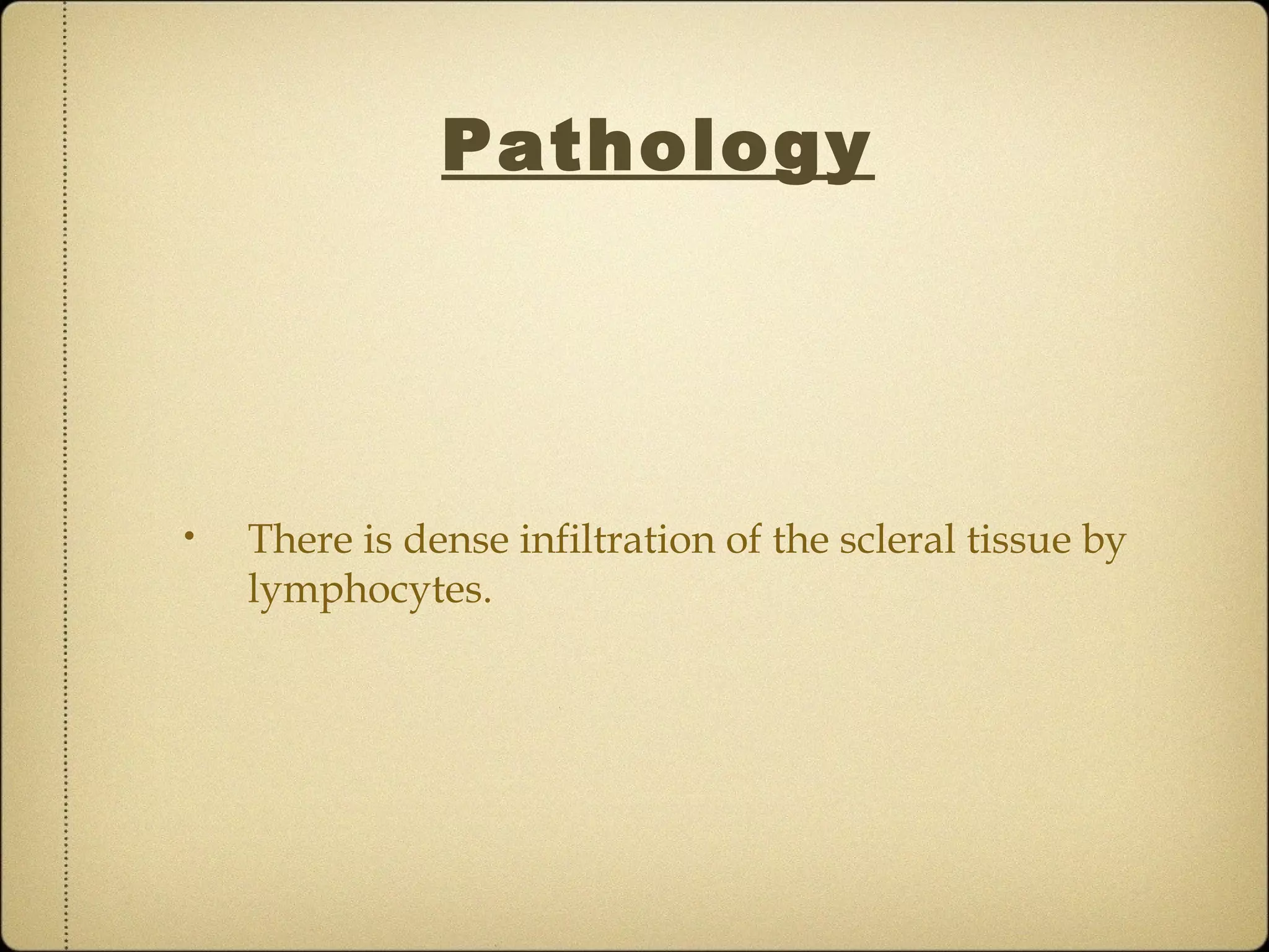 Pathology




•   There is dense infiltration of the scleral tissue by
    lymphocytes.
 