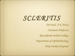 SCLERITIS
            Dr.Fuad A K Niazi,
             Assistant Professor,
      Rawalpindi medical college,
   Department of Ophthalmology,
           Holy Family Hospital.
 