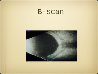 B-scan
 
