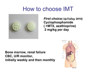 How to choose IMT  First choice ( UpToDay 2010) Cyclophosphamide ( >MTX, azathioprine) 2 mg/kg per day Bone marrow, renal failure CBC, U/R monitor,  initially weekly and then monthly 