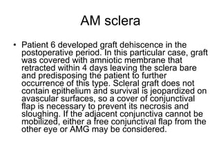 AM sclera Patient 6 developed graft dehiscence in the postoperative period. In this particular case, graft was covered with amniotic membrane that retracted within 4 days leaving the sclera bare and predisposing the patient to further occurrence of this type. Scleral graft does not contain epithelium and survival is jeopardized on avascular surfaces, so a cover of conjunctival flap is necessary to prevent its necrosis and sloughing. If the adjacent conjunctiva cannot be mobilized, either a free conjunctival flap from the other eye or AMG may be considered. 
