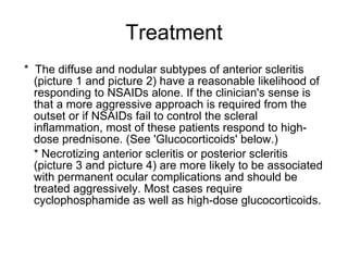 Treatment *  The diffuse and nodular subtypes of anterior scleritis (picture 1 and picture 2) have a reasonable likelihood of responding to NSAIDs alone. If the clinician's sense is that a more aggressive approach is required from the outset or if NSAIDs fail to control the scleral inflammation, most of these patients respond to high-dose prednisone. (See 'Glucocorticoids' below.) * Necrotizing anterior scleritis or posterior scleritis (picture 3 and picture 4) are more likely to be associated with permanent ocular complications and should be treated aggressively. Most cases require cyclophosphamide as well as high-dose glucocorticoids. 