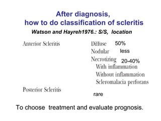 Watson and Hayreh1976.: S/S,  location After diagnosis, how to do classification of scleritis 50% 20-40% less rare To choose  treatment and evaluate prognosis.  