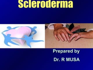 Scleroderma  Prepared by Dr. R MUSA 